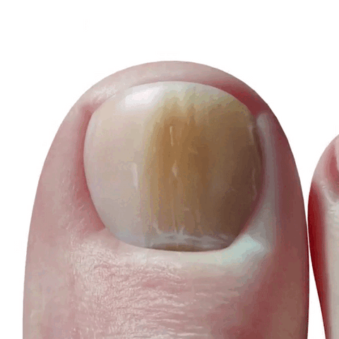 Nail Magic-Óleo Regenerador de Uñas